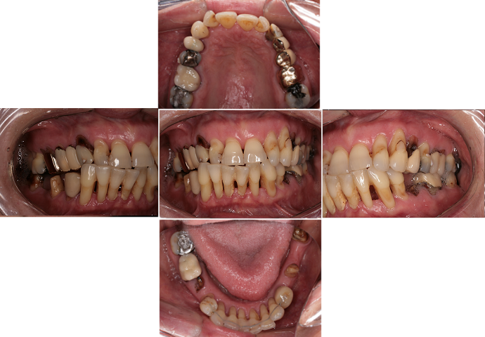 Situace v ústech - vlevo, vpravo, uprostřed, v dolní a horní čelisti