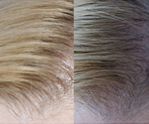 Testování šamponu proti vypadávání vlasů Renokin 